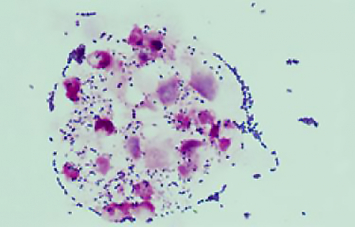 Les infections invasives à Streptocoque A (Streptococcus pyogenes ...